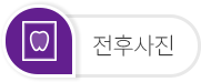 치료전후사진