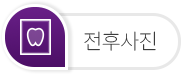 치료전후사진